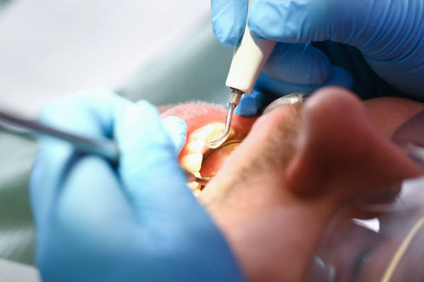 Best Emergency Denture Repair in Aurora, OH